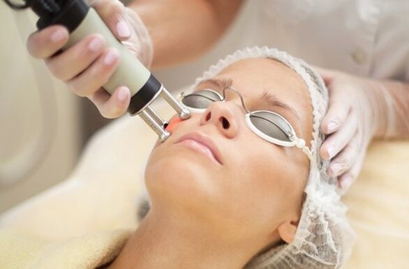 Heat exposure to the epidermis